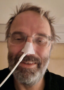 Photo of Hugo Kornelis, with a feeding tube in his nose.